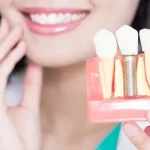 role of periodontist in dental implants