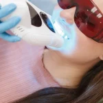 use of high tech equipments in rct