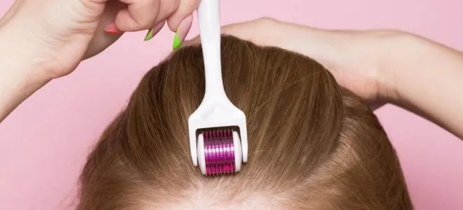 microneedling